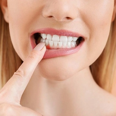 علاج تراجع اللثة في دبي وأبو ظبي والشارقة والعين