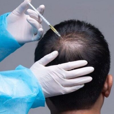 علاج فوس للشعر في دبي وأبو ظبي والشارقة والعين