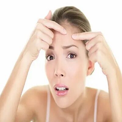 تقنية براد بيت لإزالة ندبات حب الشباب